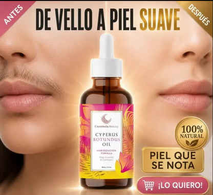 CYPERUS ROTUNDUS OIL X 60 ML de Caramela Beauty